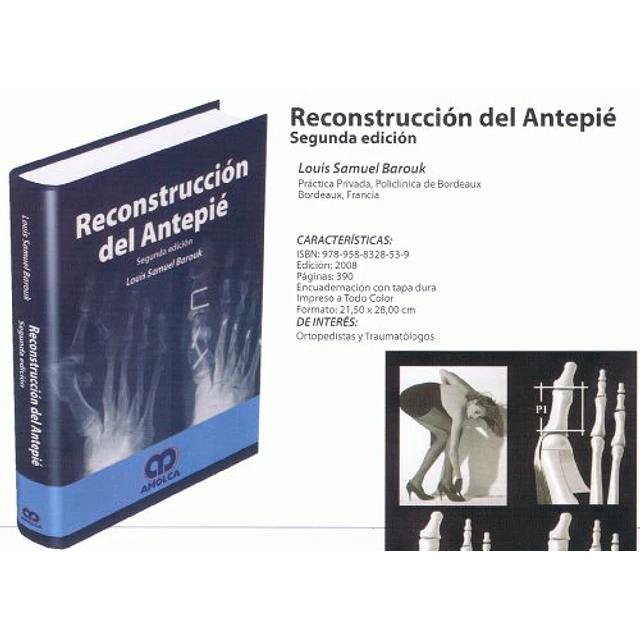 Reconstrucción del Antepié