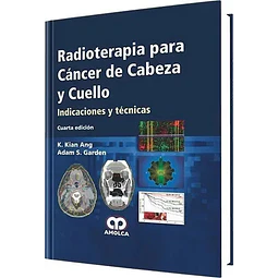 Radioterapia para Cáncer de CAbeza y Cuello