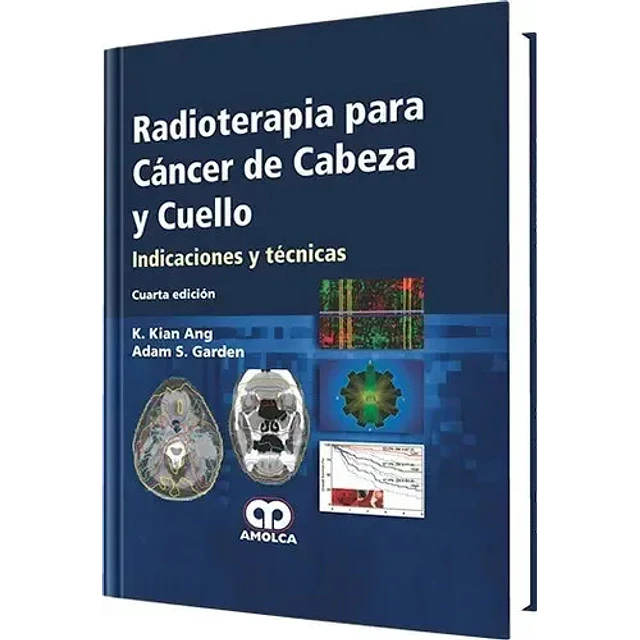Radioterapia para Cáncer de CAbeza y Cuello