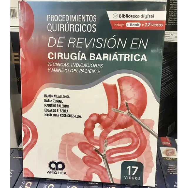 Procedimientos quirúrgicos de revisión en Cirugía baríatrica.
