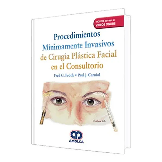 Procedimientos Mínimamente Invasivos de Cirugía Plastica Facial en el Consultorio