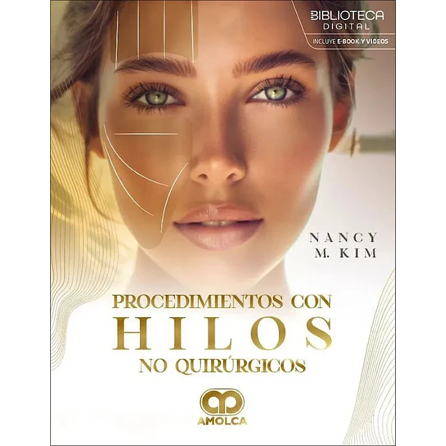 Procedimientos con hilos no quirúrgicos.