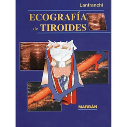 Ecografia de tiroides