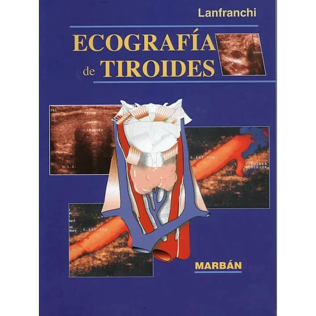 Ecografia de tiroides