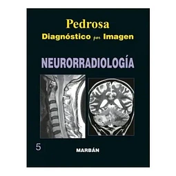 Pedrosa Diagnóstico por Imagen Neurorradiología 5