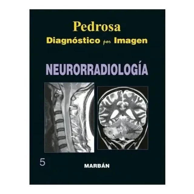 Pedrosa Diagnóstico por Imagen Neurorradiología 5