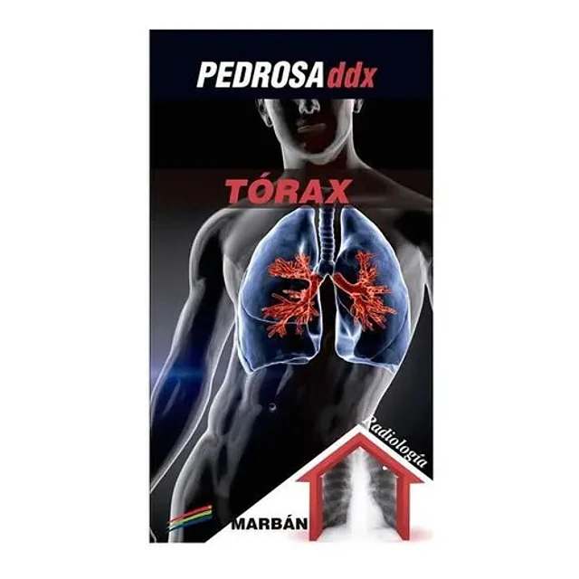 Pedrosa ddx Tórax