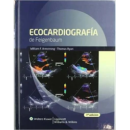 Ecocardiografía de Feigenbaum