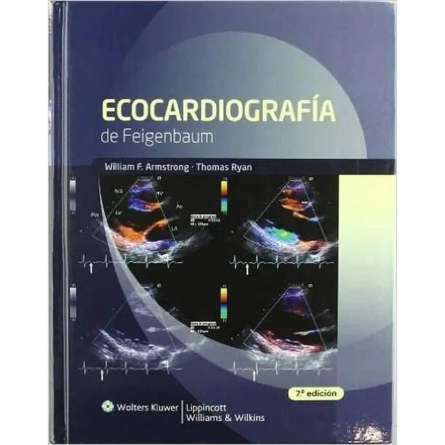 Ecocardiografía de Feigenbaum