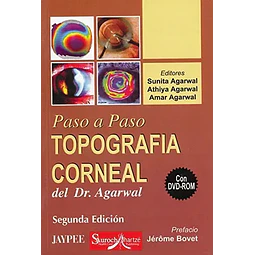 Topografía Corneal del Dr. Agarwal