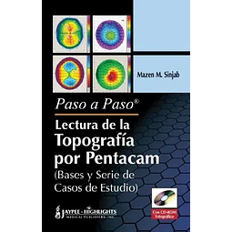 Lectura de la Topografía por Pentacam