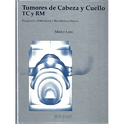 TC y RM de los tumores de cabeza y cuello