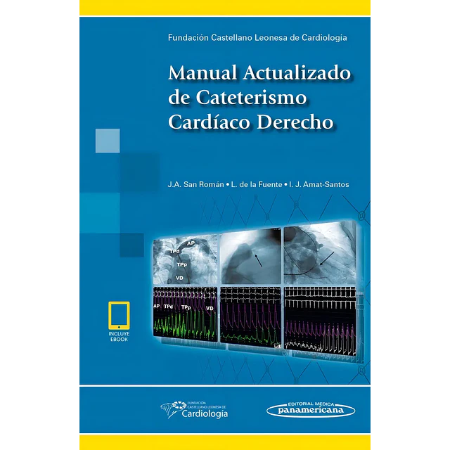 Manual Actualizado de Cateterismo Cardíaco Derecho
