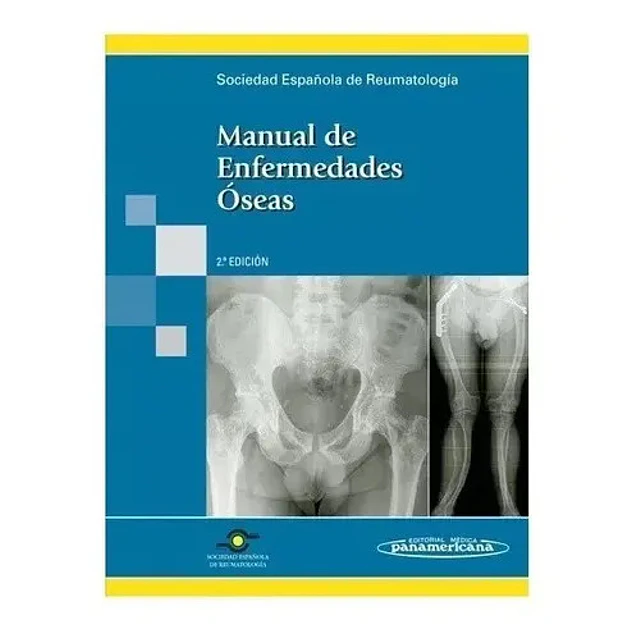 Manual de Enfermedades Óseas