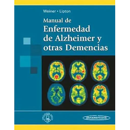 Manual de Enfermedad de Alzheimer y otras Demencias