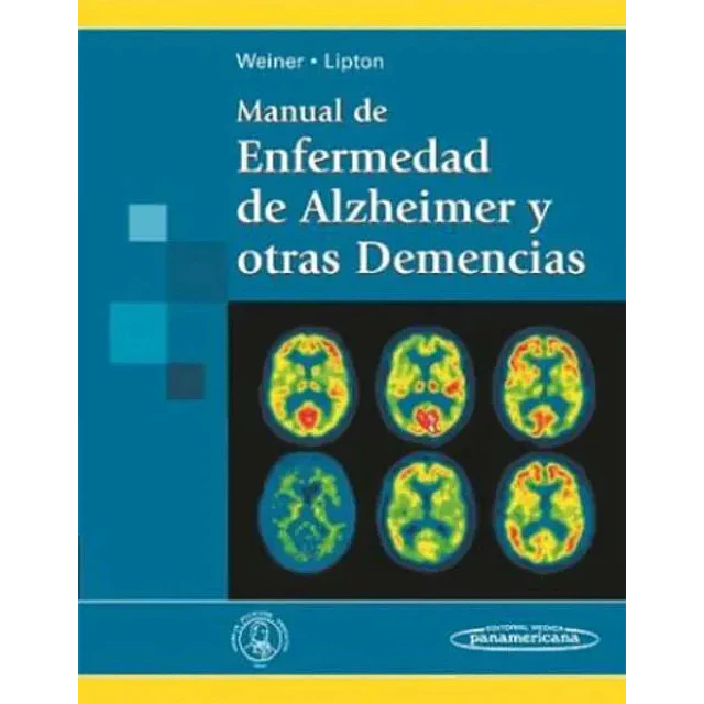 Manual de Enfermedad de Alzheimer y otras Demencias