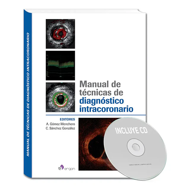 Manual de Técnicas de Diagnóstico Intracoronario