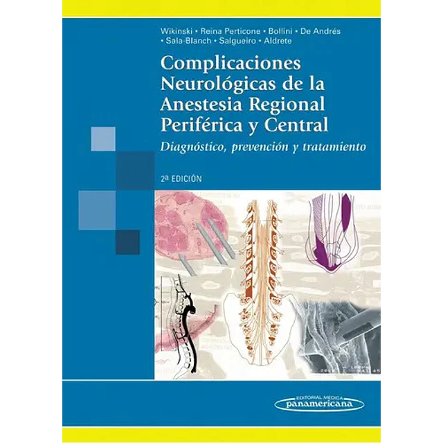 Complicaciones Neurológicas de la Anestesia Regional Periférica y Central