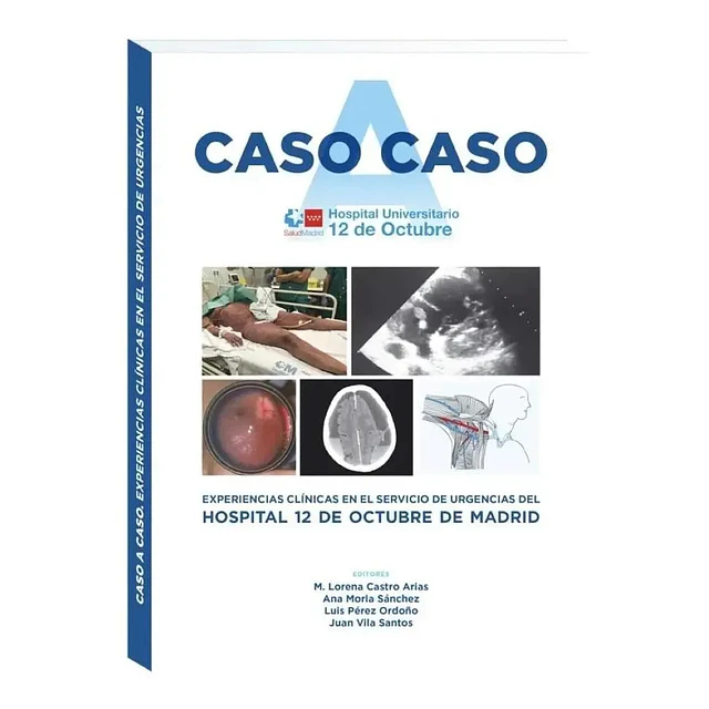Caso a caso.