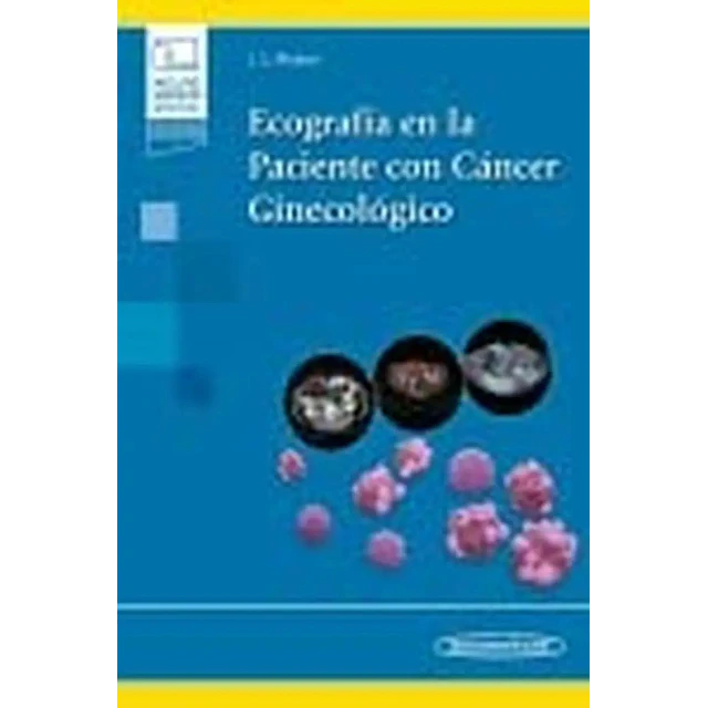Ecografía en la paciente con cáncer ginecológico