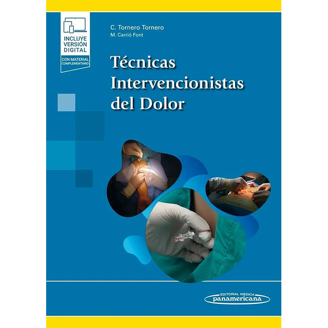Técnicas intervencionistas del dolor