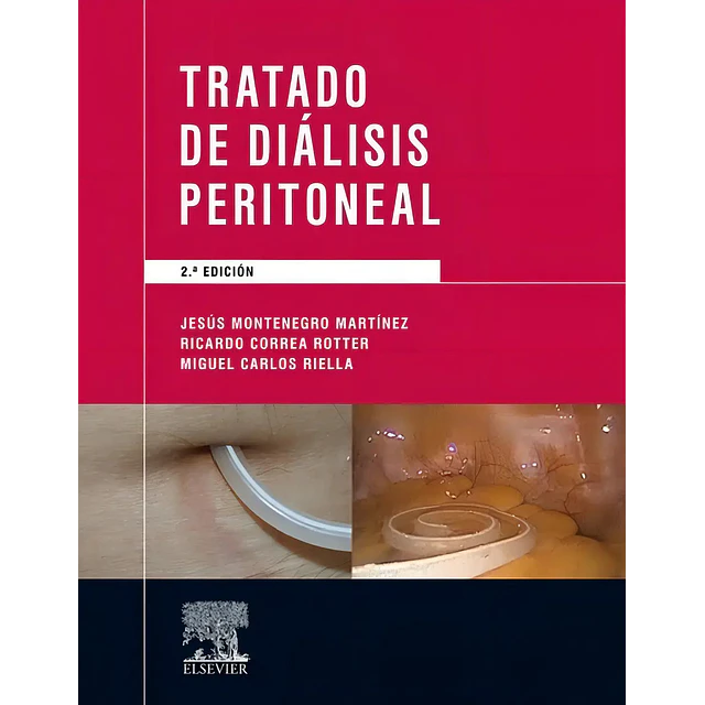 Tratado de diálisis peritoneal