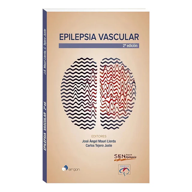 Epilepsia Vascular