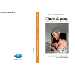 Cancer de Mama Temas Actuales