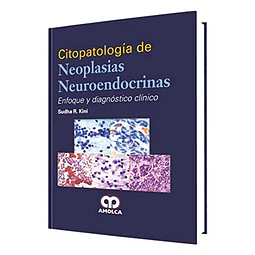 Citopatología de neoplasias neuroendócrinas