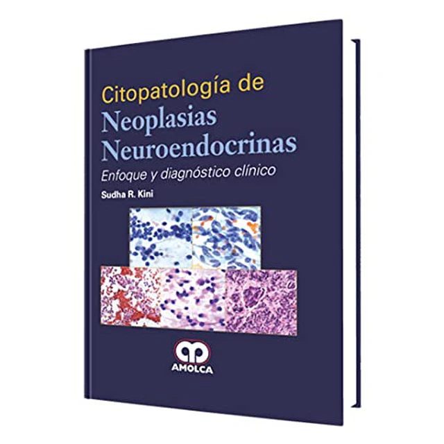 Citopatología de neoplasias neuroendócrinas