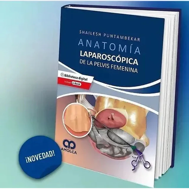 Anatomía laparoscópica de la pelvis femenina