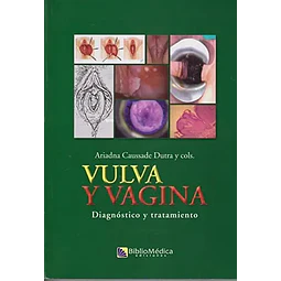 Vulva y Vagina