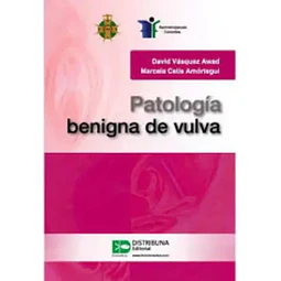 Patología Benigna de la Vulva