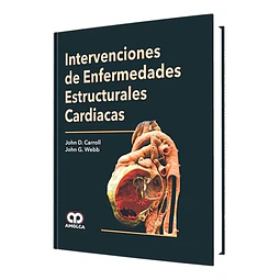 Intervenciones de enfermedades estructurales cardiacas