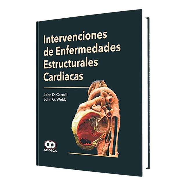 Intervenciones de enfermedades estructurales cardiacas