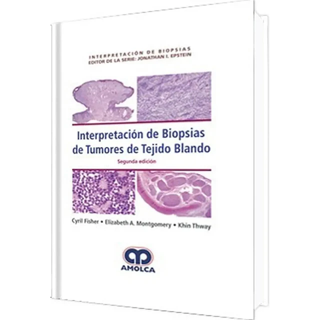 Interpretación de Biopsias de Tumores de Tejido Blando