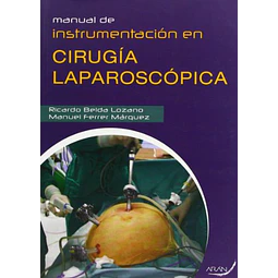 Manual de instrumentación en cirugía laparoscópica