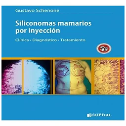 Siliconomas mamarios por inyección. Clínica, diagnóstico, tratamiento