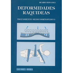 Tratamiento medico-ortopedico deformaciones raquideas