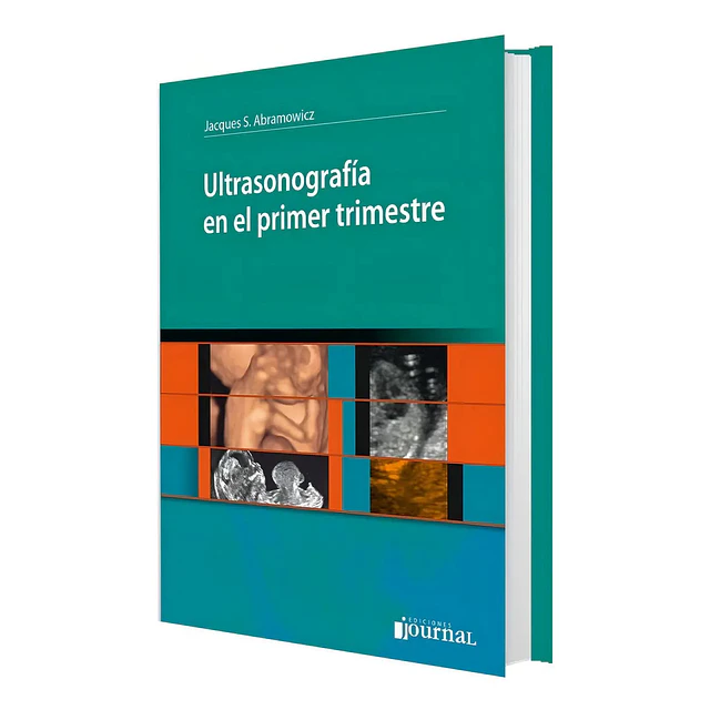 Ultrasonografía en el primer trimestre