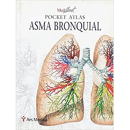 Asma Bronquial Pocket Atlas