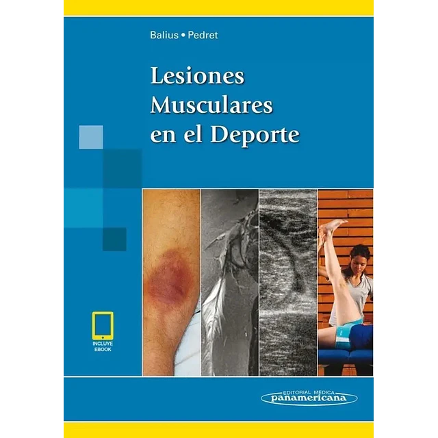 Lesiones Musculares en el Deporte