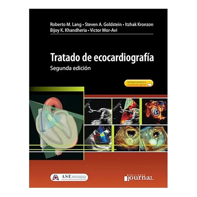 Tratado de Ecocardiografía