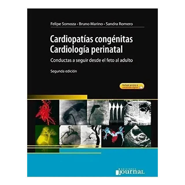 Cardiopatías congénitcas. Cardiología perinatal