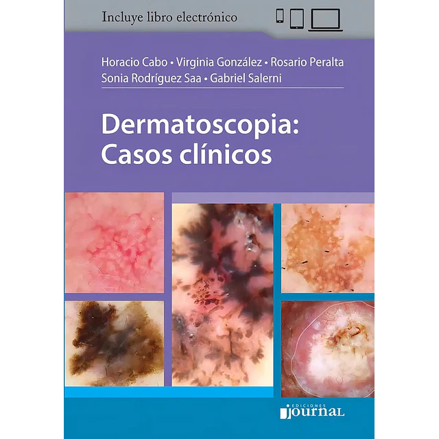 Dermatoscopia : casos clínicos