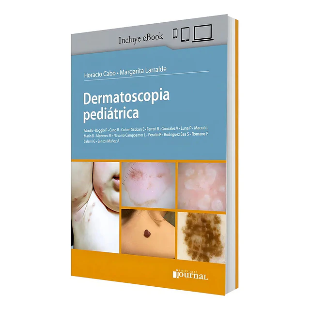 Dermatoscopia pediátrica