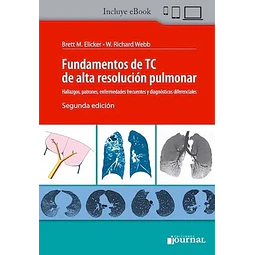 Fundamento de TC de alta resolución pulmonar