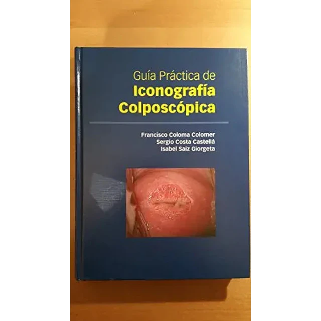 Guía práctica de iconografía colposcópica