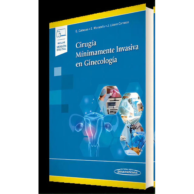 Cirugía Mínimamente Invasiva en Ginecología