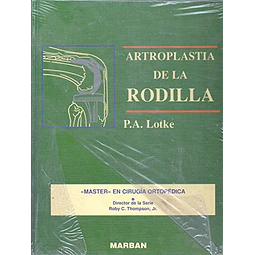 Artroplastia de la rodilla : master en cirugia ortopedica